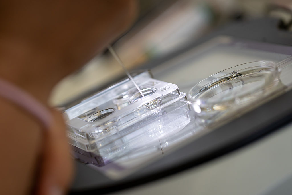 Childhood cancer risk may be higher after some fertility treatments, study finds — FOX 13 Tampa Bay News, Siesta Key Community news